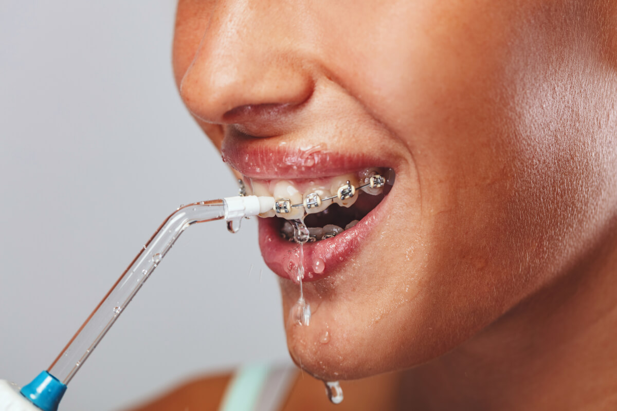 Woman Using Water Flosser on Teeth with Braces